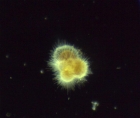 Foraminifère