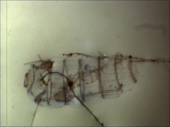 Doliolum denticulatum