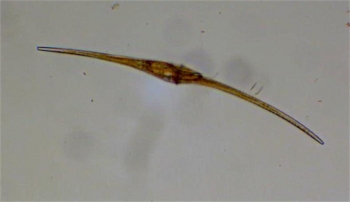 Ceratium fusus