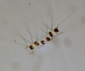 Chaetoceros
