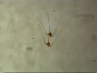 Ceratium pavillardii