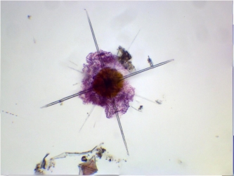 Acanthaire (Acanthochiasma rubescens)